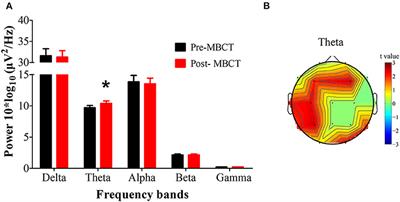 Mindfulness-Based Cognitive Therapy in Recurrent MDD Patients With Residual Symptoms: Alterations in Resting-State Theta Oscillation Dynamics Associated With Changes in Depression and Rumination